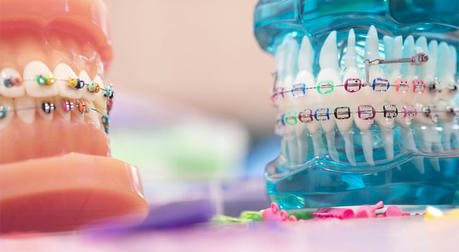 How To Choose The Best Orthodontic Treatment For You