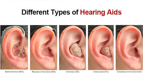 Comparing Hearing Aids for Seniors: Which One is Right for You?