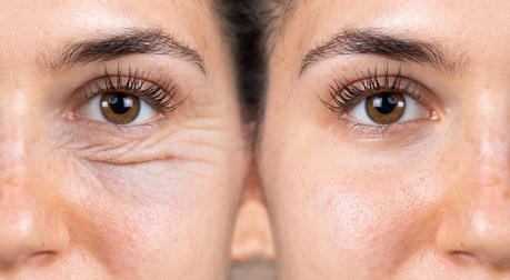 Rejuvenate Your Eyes: The Secret to Looking 10 Years Younger with Blepharoplasty